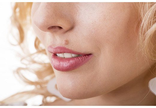 белая родинка над губой