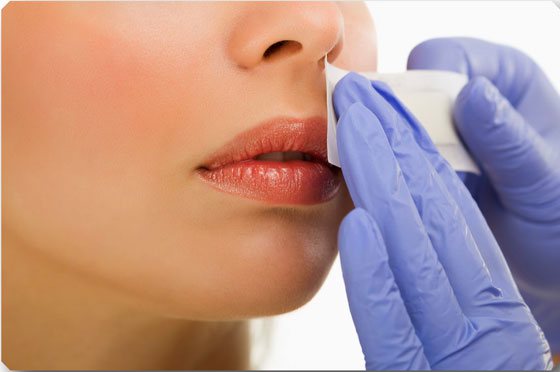 Депиляция над верхней губе