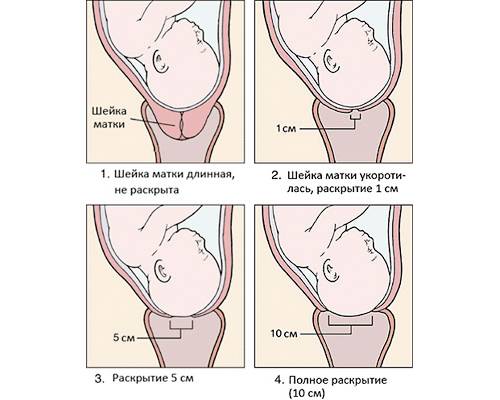 Расстояние до шейки матки