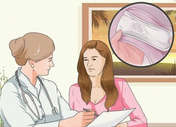 врач рассказывает про выделения